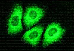 Imagen del virus de la hepatitis C Imagen del virus de la hepatitis C